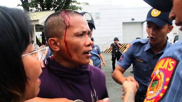 A protester bleeds after being clubbed by the police.